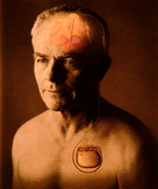 Medtronic